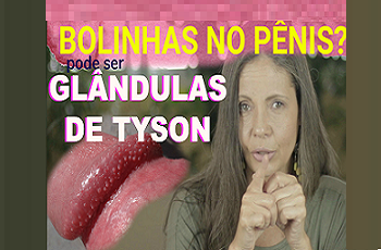 Bolinhas no pênis podem ser Glândulas de Tyson