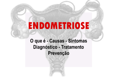 Endometriose o que é, sintomas, causas, diagnóstico e tratamento