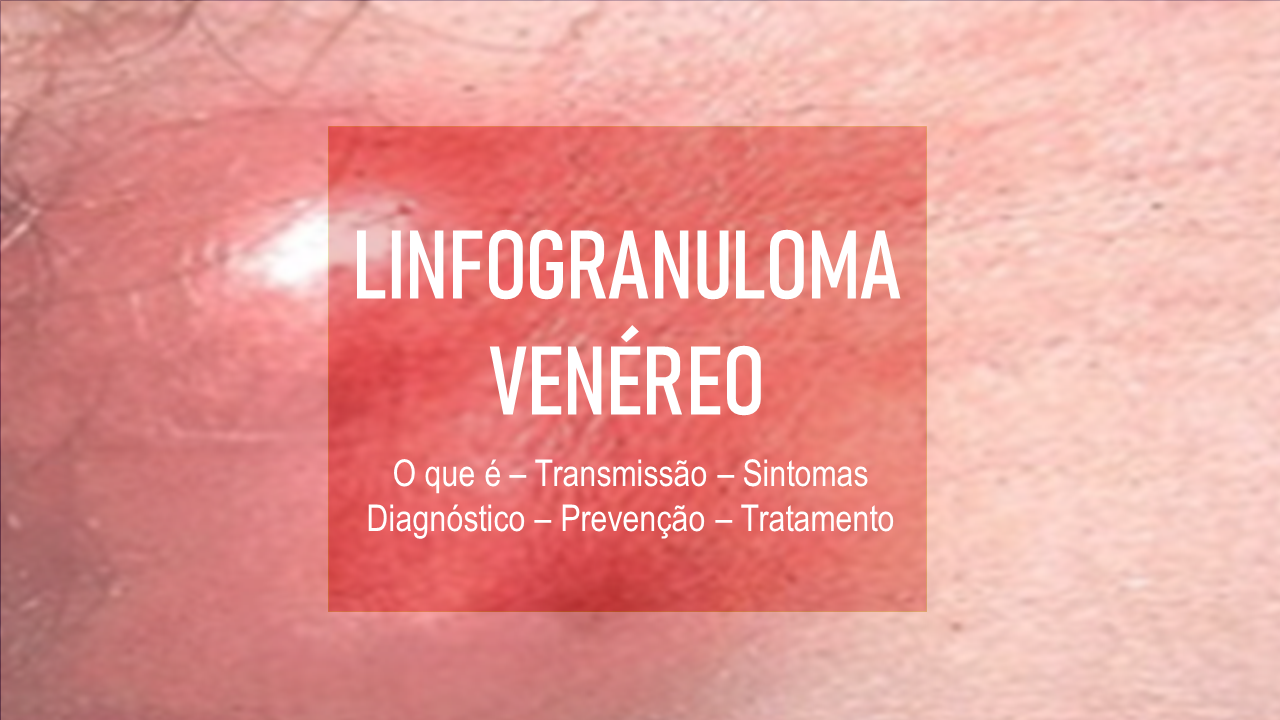 Venereo Linfogranuloma venéreo
