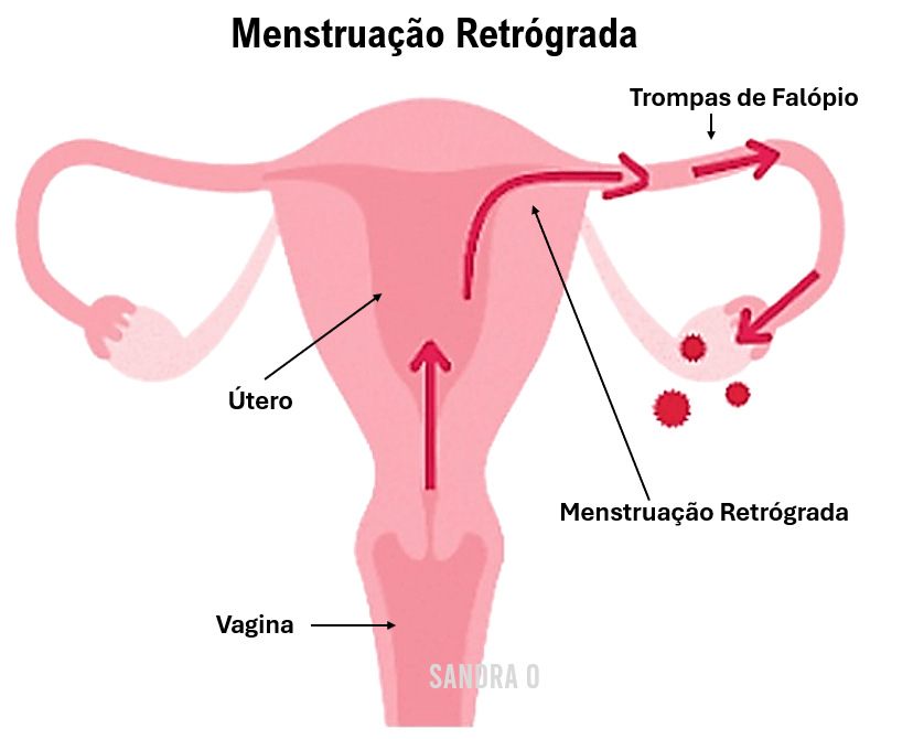 Menstruação retrógrada imagem